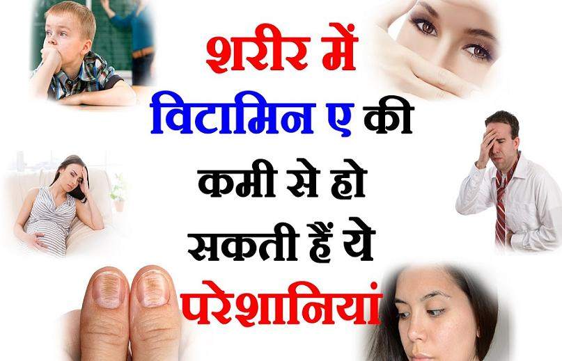 व ट म न ए क कम स ह न व ल र ग Homeopathic Medicine And Treatment In Hindi